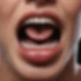 Illustration showing the oral cavity affected by gonorrhea