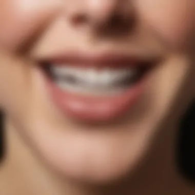 Teeth Whitening Results Comparison Before and after comparison of teeth whitening results