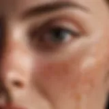 Visual representation of tinea versicolor skin condition