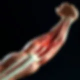 Understanding Muscle Contraction Diagram illustrating muscle contraction and spasms