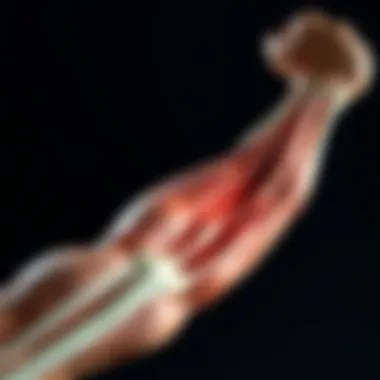 Understanding Muscle Contraction Diagram illustrating muscle contraction and spasms