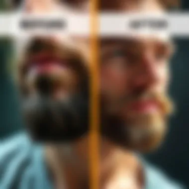 Before and After Results of Minoxidil Use Before and after comparison of beard growth with minoxidil usage