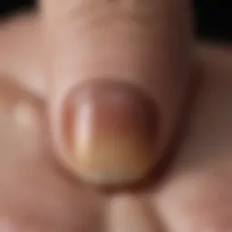 Darkly Discolored Toenail