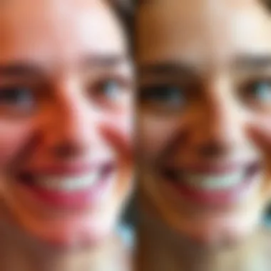 Before and After Results Using Whitening Strips Before and after results of using whitening strips